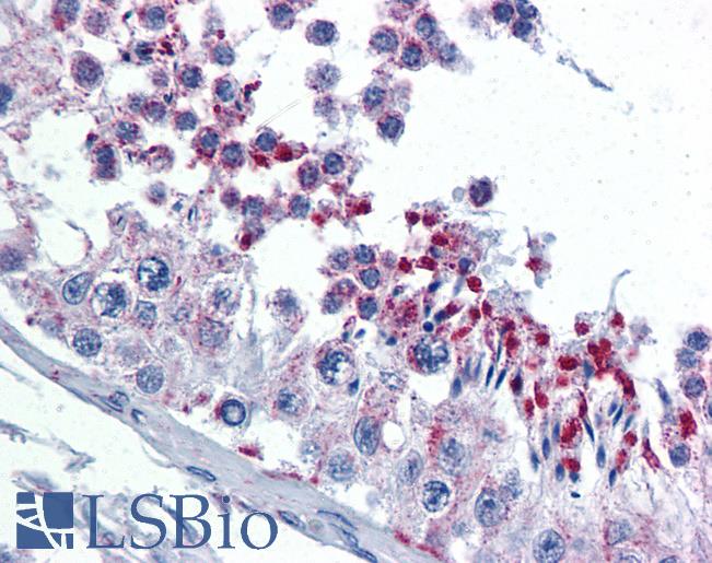 Anti-GMPS antibody IHC of human testis. Immunohistochemistry of formalin-fixed, paraffin-embedded tissue after heat-induced antigen retrieval. Antibody LS-B4476 concentration 5 ug/ml.