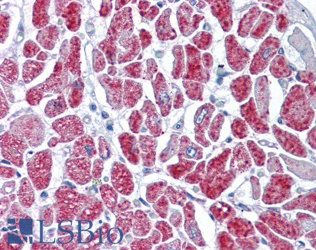 Anti-GMPS antibody IHC of human heart. Immunohistochemistry of formalin-fixed, paraffin-embedded tissue after heat-induced antigen retrieval. Antibody LS-B4476 concentration 5 ug/ml.