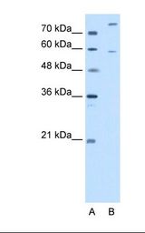 Lane A: Marker. Lane B: HepG2 cell lysate. Antibody concentration: 2.5 ug/ml. Gel concentration: 12%.