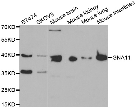 Western blot analysis of extracts of various cell lines, using GNA11 antibody.