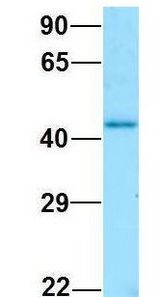 GNA11 antibody Western Blot of Human Fetal Kidney. Antibody Dilution: 1.0ug/ml. Antibody dilution: 1 ug/ml.