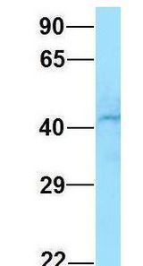 GNA11 antibody Western Blot of 293T lysate. Antibody Dilution: 1.0ug/ml. There is BioGPS gene expression data showing that GNA11 is expressed in HEK293T. Antibody dilution: 1 ug/ml.