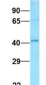 GNA11 antibody Western Blot of HeLa lysate. Antibody Dilution: 1.0ug/ml. There is BioGPS gene expression data showing that GNA11 is expressed in HeLa. Antibody dilution: 1 ug/ml.
