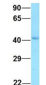 GNA11 antibody Western Blot of 721_B lysate. Antibody Dilution: 1.0 ug/ml. There is BioGPS gene expression data showing that GNA11 is expressed in 721_B. Antibody dilution: 1 ug/ml.