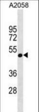 GNA11 Antibody western blot of A2058 cell line lysates (35 ug/lane). The GNA11 antibody detected the GNA11 protein (arrow).