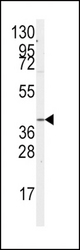 Western blot of anti-GNA12 Antibody (S67) in A2058 cell line lysates (35 ug/lane). GNA12(arrow) was detected using the purified antibody.