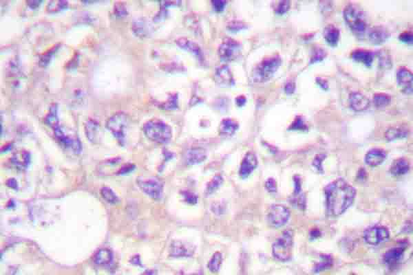 Immunohistochemistry (IHC) analysis of p-Cot (T290) pAb in paraffin-embedded human brain tissue.