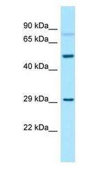 GNA13 antibody Western Blot of 721_B.