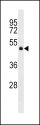 GNA13 Antibody western blot of HepG2 cell line lysates (35 ug/lane). The GNA13 antibody detected the GNA13 protein (arrow).