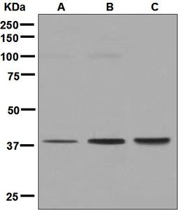 Western blot analysis on (A) Y79, (B) 293T, and (C) HepG2 cell lysates using anti-GNA13 antibody.