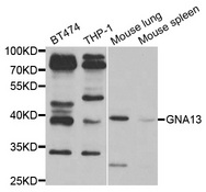 Western blot analysis of extracts of various cell lines, using GNA13 antibody.