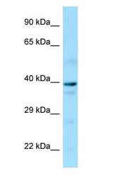 GNA14 antibody Western Blot of Human brain.