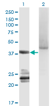 Western blot of GNA14 expression in transfected 293T cell line by GNA14 monoclonal antibody (M06), clone 2H8.