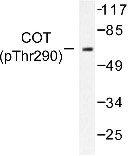 Western blot of p-Cot (T290) pAb in extracts from 293 cells treated with UV.
