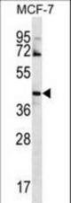 GNA14 Antibody western blot of MCF-7 cell line lysates (35 ug/lane). The GNA14 antibody detected the GNA14 protein (arrow).