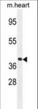 GNA15 Antibody western blot of mouse heart tissue lysates (35 ug/lane). The GNA15 antibody detected the GNA15 protein (arrow).