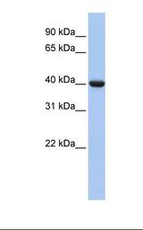 Fetal lung lysate. Antibody concentration: 1.0 ug/ml. Gel concentration: 12%.