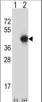 Western blot of GNAI2 (arrow) using rabbit polyclonal GNAI2 Antibody. 293 cell lysates (2 ug/lane) either nontransfected (Lane 1) or transiently transfected (Lane 2) with the GNAI2 gene.