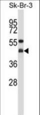 GNAI2 Antibody western blot of SK-BR-3 cell line lysates (35 ug/lane). The GNAI2 antibody detected the GNAI2 protein (arrow).