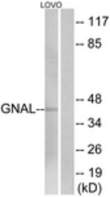 Western blot of extracts from LOVO cells, using GNAL Antibody. The lane on the right is treated with the synthesized peptide.
