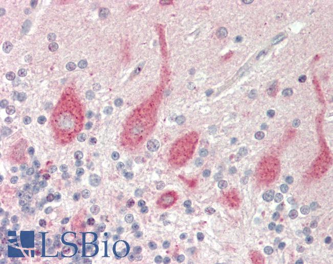 Human Brain, Cerebellum: Formalin-Fixed, Paraffin-Embedded (FFPE)