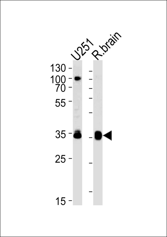 GNAO1 Antibody western blot of U251 cell line and rat brain lysates (35 ug/lane). The GNAO1 antibody detected the GNAO1 protein (arrow).