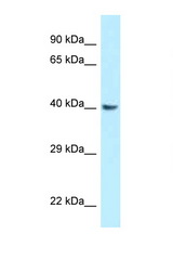 GNAQ antibody LS-C146104 Western blot of Rat Brain lysate. Antibody concentration 1 ug/ml.
