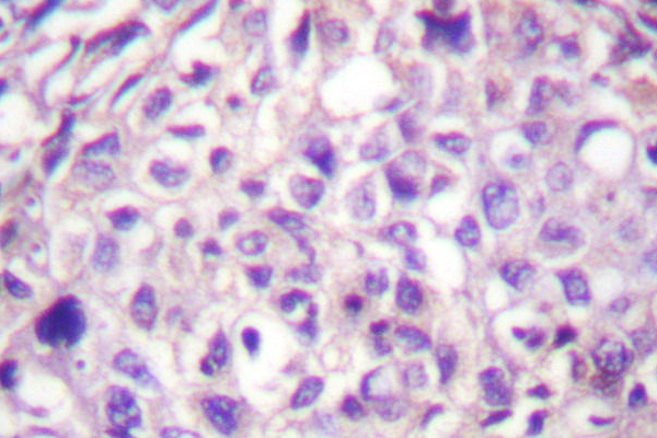 IHC of COT (P284) pAb in paraffin-embedded human brain tissue.