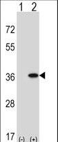 Western blot of GNAQ (arrow) using rabbit polyclonal GNAQ Antibody. 293 cell lysates (2 ug/lane) either nontransfected (Lane 1) or transiently transfected (Lane 2) with the GNAQ gene.