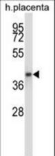 GNAQ Antibody western blot of human placenta tissue lysates (35 ug/lane). The GNAQ antibody detected the GNAQ protein (arrow).