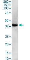 GNAQ monoclonal antibody (M04), clone 3B9. Western Blot analysis of GNAQ expression in Jurkat.