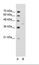 A: Marker, B: Jurkat Cell Lysate
