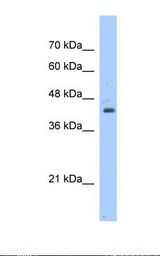 Jurkat cell lysate. Antibody concentration: 1.25 ug/ml. Gel concentration: 12%.