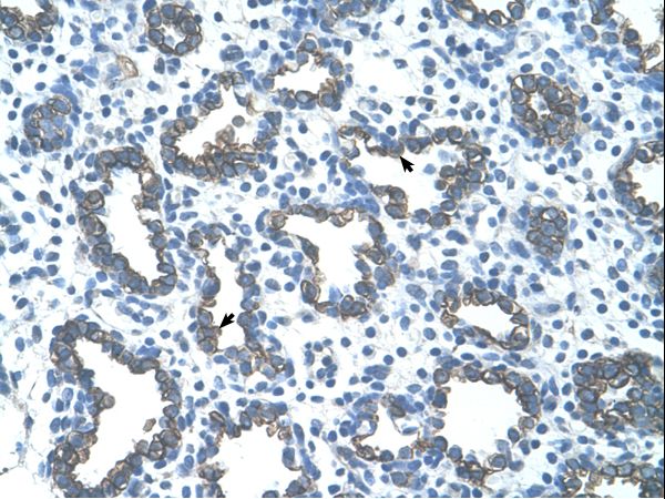 GNAS antibody LS-C31914 was used in IHC to stain formalin-fixed, paraffin-embedded human lung.