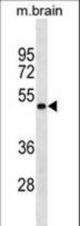 GNAS Antibody(Ascites)western blot of mouse brain tissue lysates (35 ug/lane). The GNAS antibody detected the GNAS protein (arrow).