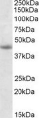 GNAS antibody (1 ug/ml) staining of Jurkat lysate (35 ug protein/ml in RIPA buffer). Primary incubation was 1 hour. Detected by chemiluminescence.