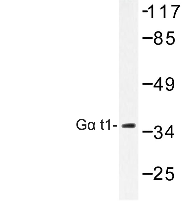 Western blot of G t1 (M104) pAb in extracts from COLO cells.