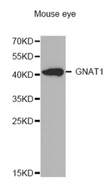 Western blot analysis of extracts of Mouse eye cell line, using GNAT1 antibody.