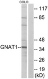 Western blot of extracts from COLO cells, using GNAT1 Antibody. The lane on the right is treated with the synthesized peptide.