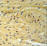 GNAT1 Antibody IHC of formalin-fixed and paraffin-embedded mouse heart tissue followed by peroxidase-conjugated secondary antibody and DAB staining.