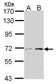 Sample (30 ug of whole cell lysate). A:293T, B: A431 . 7.5% SDS PAGE. COT antibody. COT antibody diluted at 1:1000.
