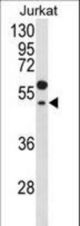 Western blot of GNAT1 Antibody in Jurkat cell line lysates (35 ug/lane). GNAT1 (arrow) was detected using the purified antibody.