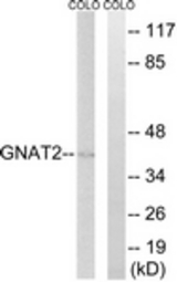 Western blot of extracts from COLO cells, using GNAT2 Antibody. The lane on the right is treated with the synthesized peptide.