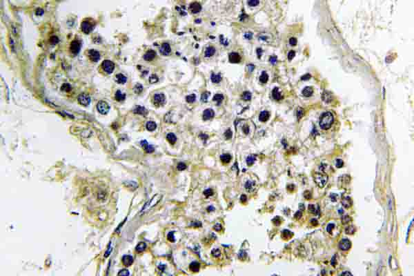 IHC of G t2 (V34) pAb in paraffin-embedded human testis tissue.