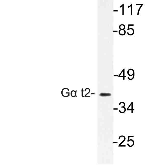 Western blot of G t2 (V34) pAb in extracts from COLO cells.