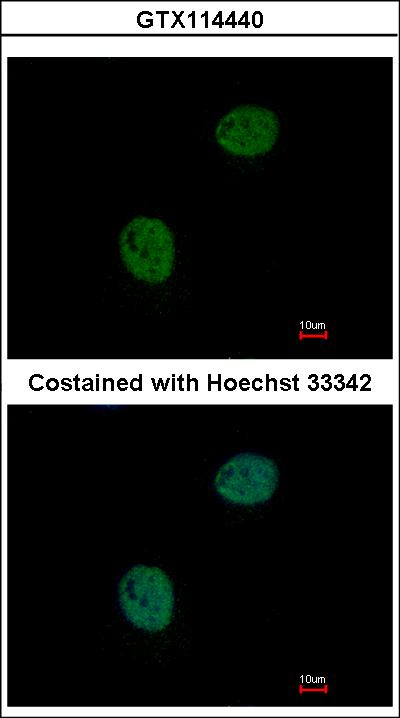 Immunofluorescence of paraformaldehyde-fixed HeLa using GNAT2 antibody at 1:500 dilution.