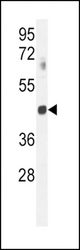 GNAT2 Antibody western blot of mouse spleen tissue lysates (35 ug/lane). The GNAT2 antibody detected the GNAT2 protein (arrow).