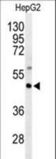Western blot of GNAZ Antibody in HepG2 cell line lysates (35 ug/lane). GNAZ (arrow) was detected using the purified antibody.