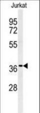 Western blot of GNB1 Antibody in Jurkat cell line lysates (35 ug/lane). GNB1 (arrow) was detected using the purified antibody.