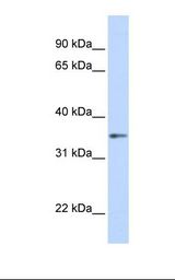Fetal brain lysate. Antibody concentration: 1.0 ug/ml. Gel concentration: 12%.